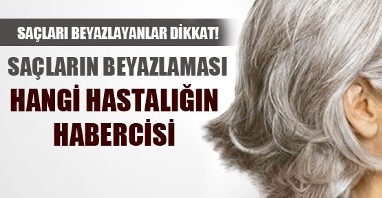SAÇI ERKEN YAŞTA BEYAZLAYANLAR DİKKAT!