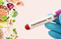 Gıda İntoleransı Testi ile Diyete Başlayın