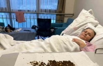 Hastadan çıkan taşları sayamadılar