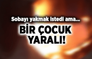 SOBAYI YAKMAK İSTERKEN EVİ YAKTI!