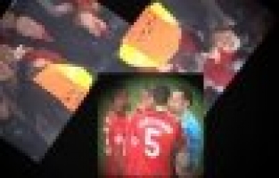 FERGUSON'U NEDEN ATAMADIN?