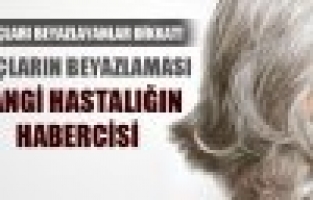 SAÇI ERKEN YAŞTA BEYAZLAYANLAR DİKKAT!